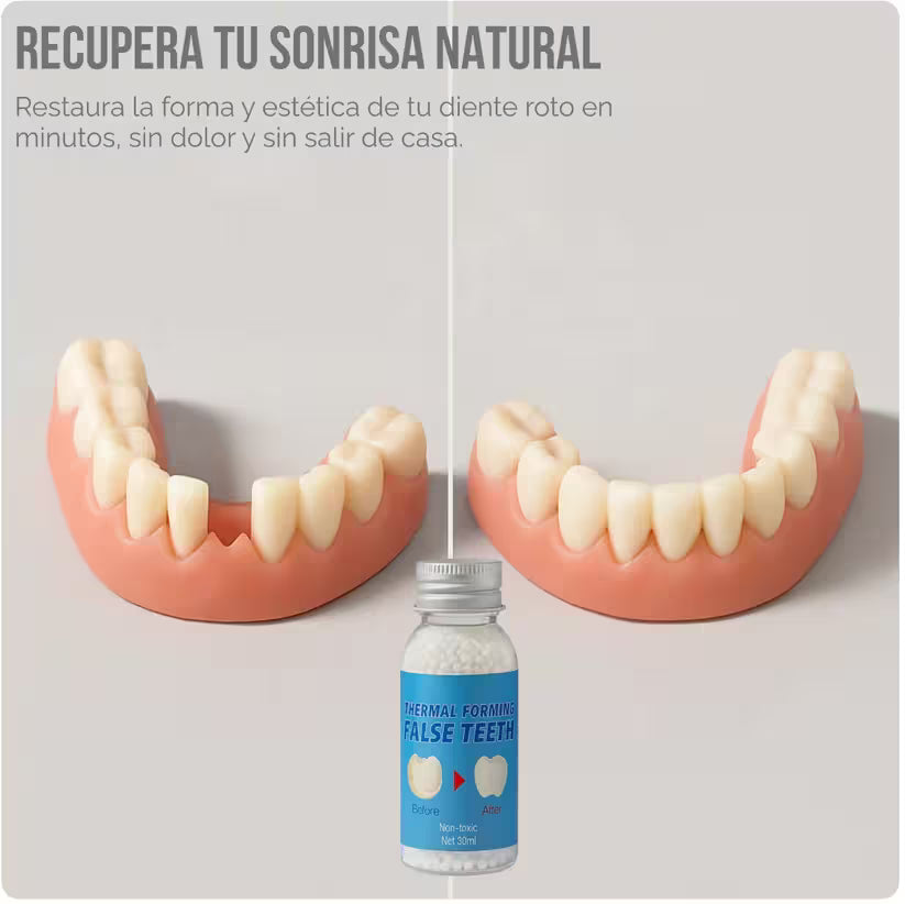 KIT DE REPARACIÓN DENTAL RESINA-FALSE TEETH