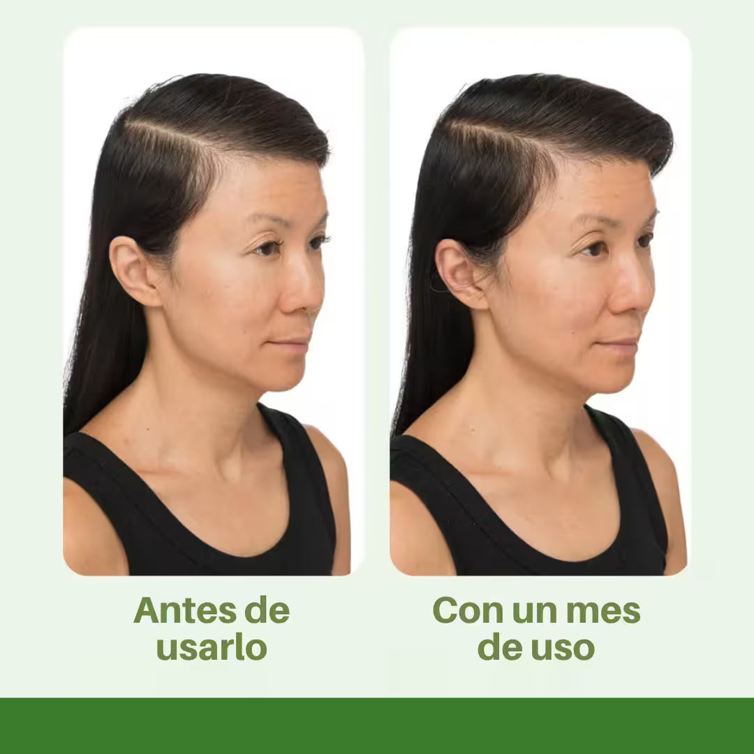 DIVI - SUERO PARA EL CUERO CABELLUDO-FORTALECIMIENTO DESDE LA RAÍZ