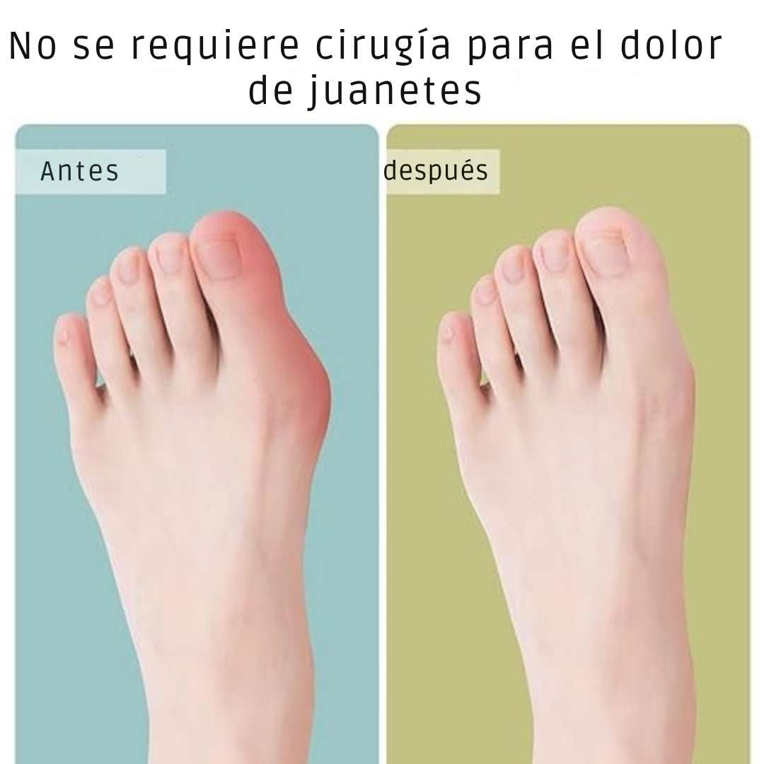 Corrector Avanzado de Juanete