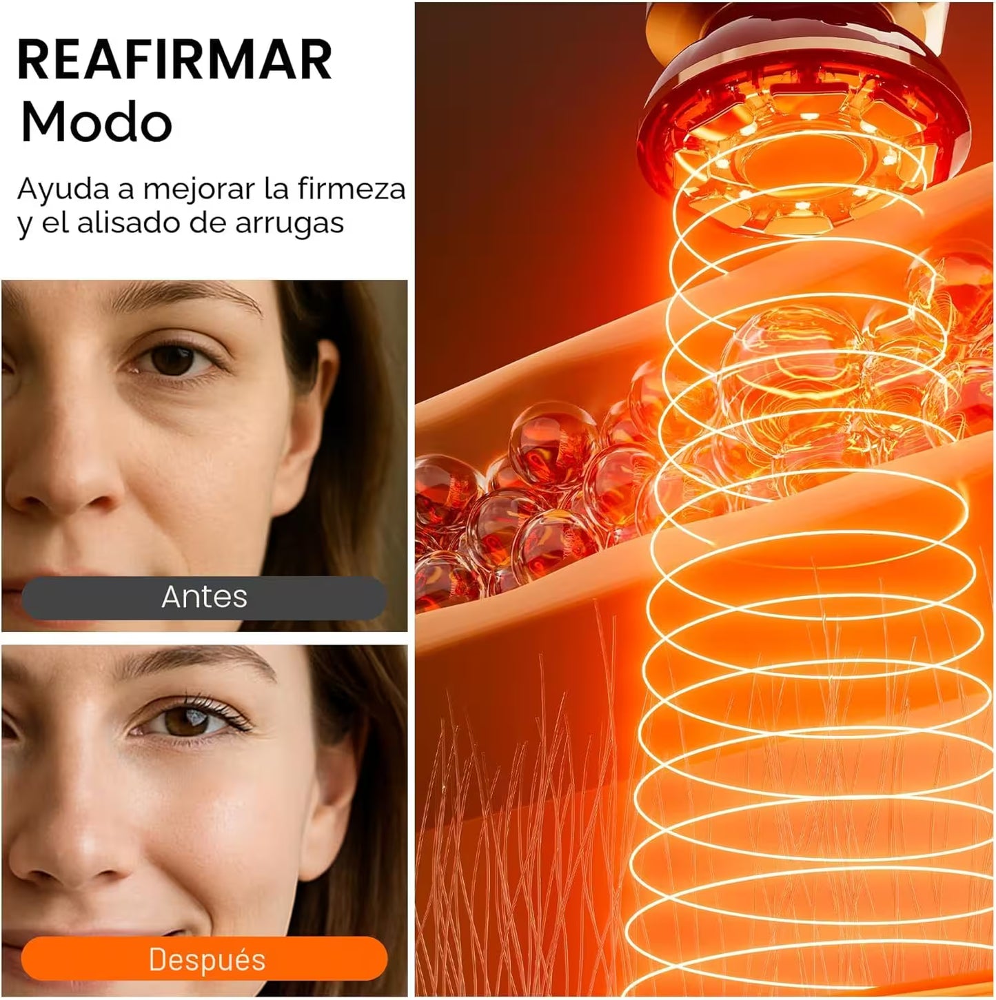 Electroporación Radiofrecuencia Facial