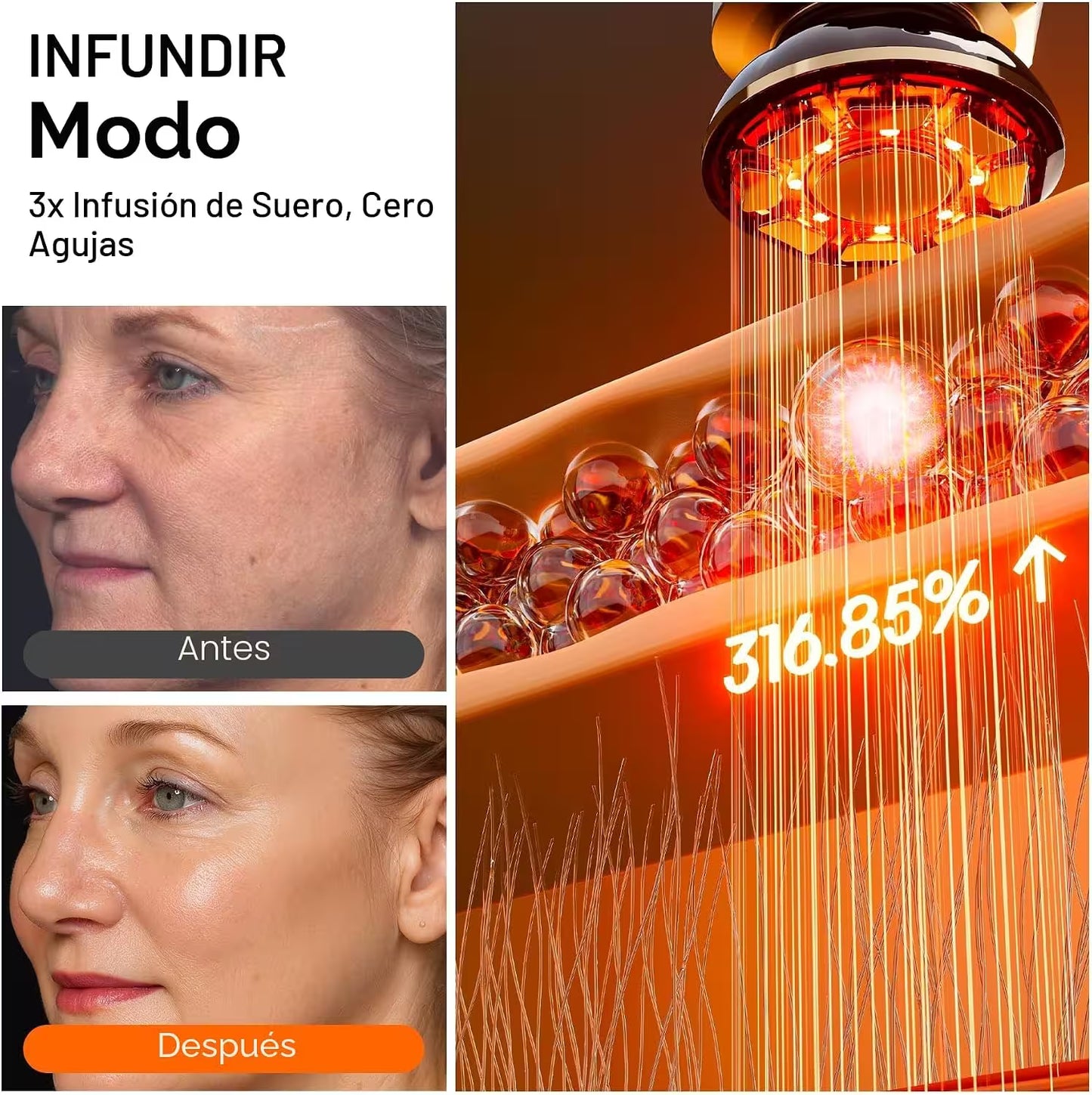 Electroporación Radiofrecuencia Facial
