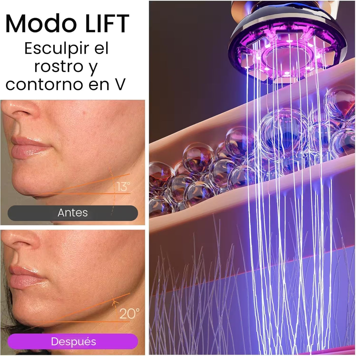 Electroporación Radiofrecuencia Facial
